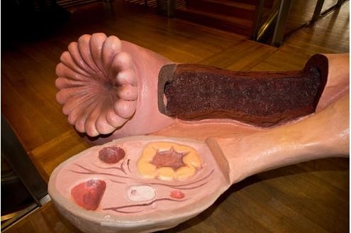 Auch dieses Modell soll für Vorsorgeuntersuchungen werben.

© www.organmodelle.de