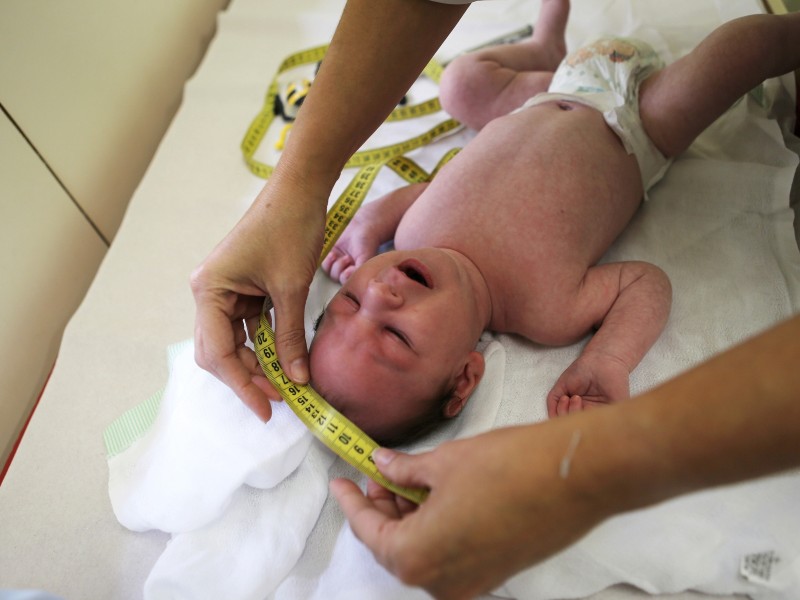 Brasilianische Forscher konnten das Zika-Virus in Gehirnen von Babys nachweisen, die mit einer Schädelfehlbildung geboren wurden. 