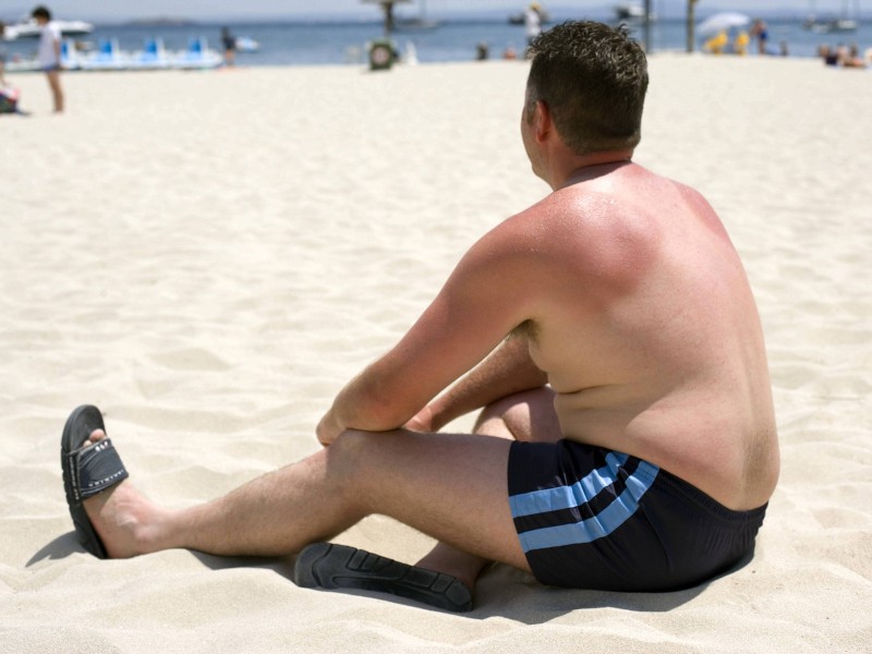 An den Strand und Klamotten vom Leib – dann eincremen. Das reicht für viele Sonnenhungrige. Experten raten jedoch dazu, sich schon vor dem Strandbesuch einzucremen, um vor der Sonne optimal geschützt zu sein. 