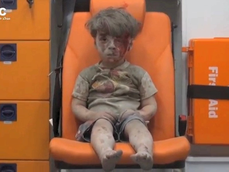 Eine Aufnahme aus Aleppo aus dem August 2016: Dieses Foto zeigt einen Jungen in einem Krankenhaus, der Opfer eines Luftangriffs wurde. 