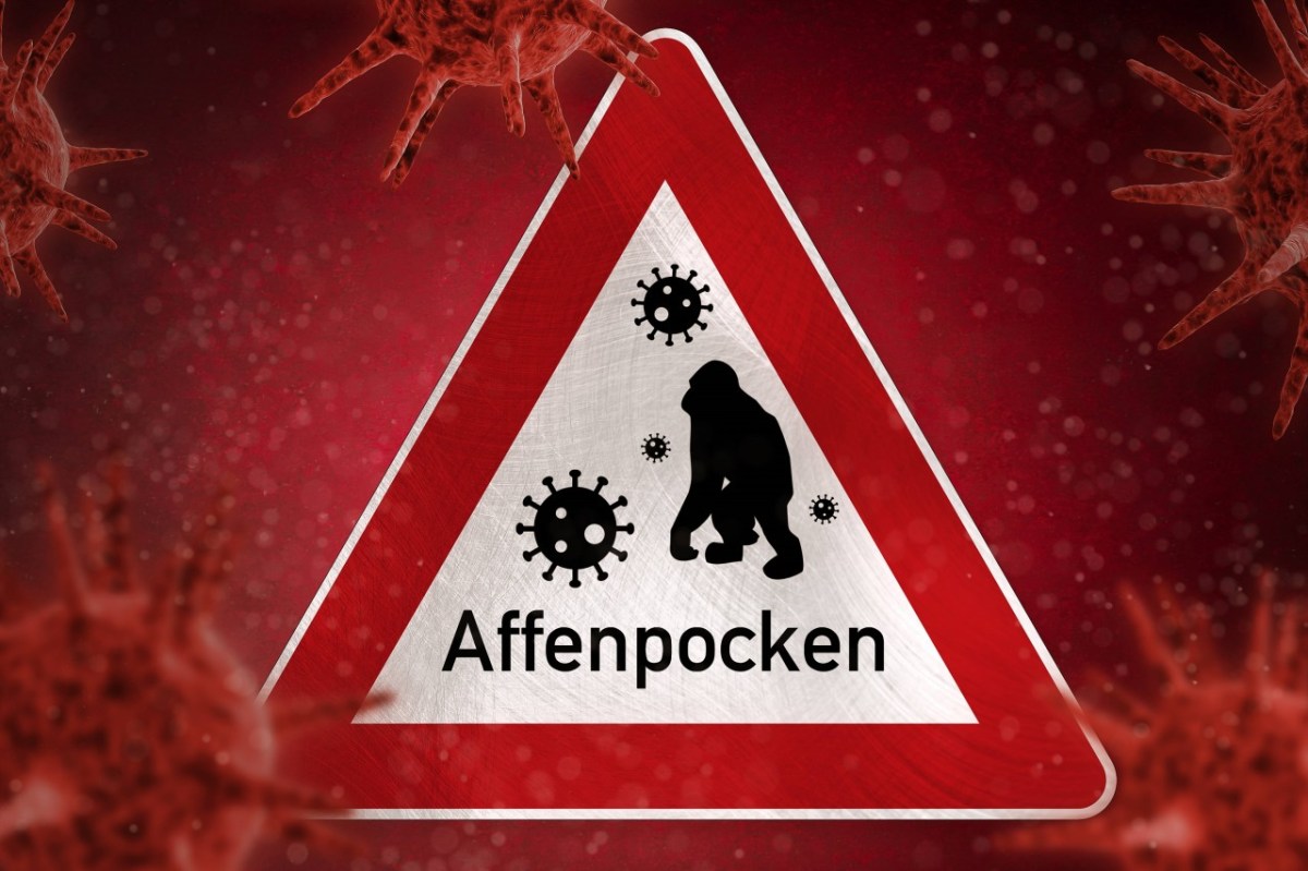 Verdacht auf Affenpocken in NRW! (Symbolfoto)