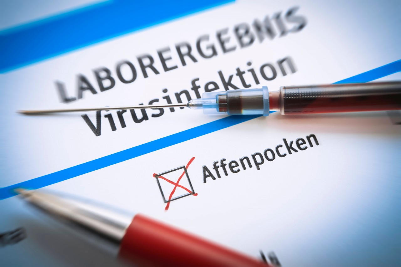 In Deutschland sind erste Fälle mit dem Affenpocken-Virus bekannt. (Symbolfoto)