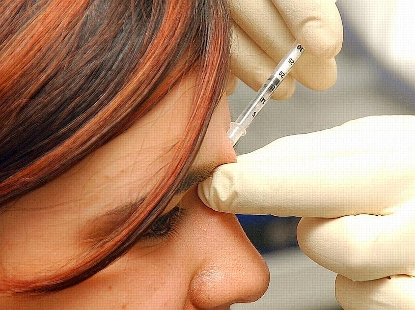 Botox Behandlung in Recklinghausen--198x148.jpg