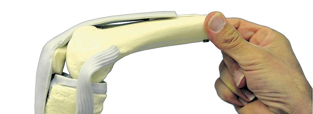 Kniegelenk Modell--656x240.jpg