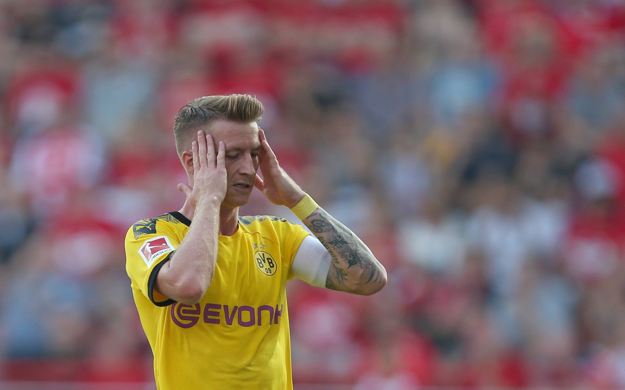 Zum Haareraufen: Die 1:3-Niederlage von Borussia Dortmund bei Union Berlin.