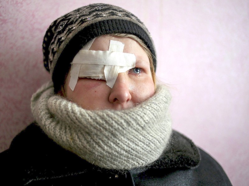 Die 18-jährige Yulia wurde am Auge verletzt und wartet auf Hilfe.