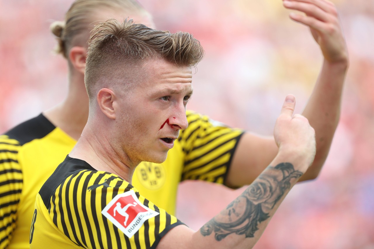 Marco Reus wird von Odilon Koussounou im Gesicht verletzt.