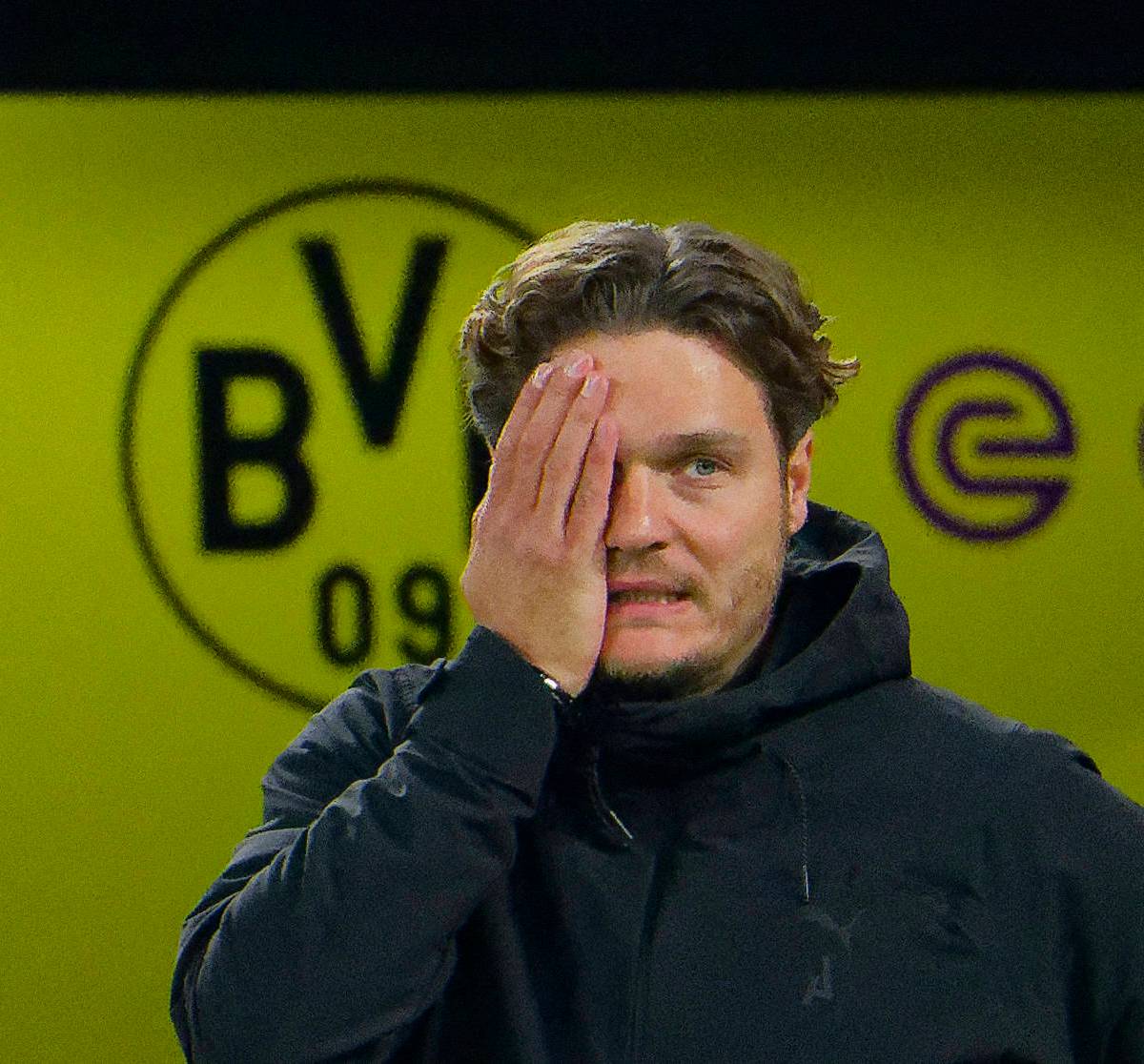 Borussia Dortmund: Nach Klassiker-Debakel – Terzic bedient vom BVB-Team